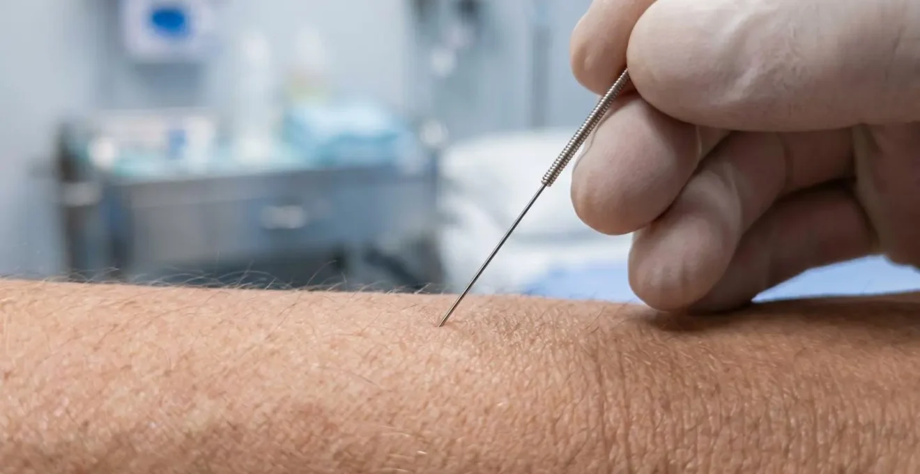 Séance d'acupuncture en milieu hospitalier français pour patient en oncologie